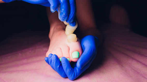 Sugaring on legs
